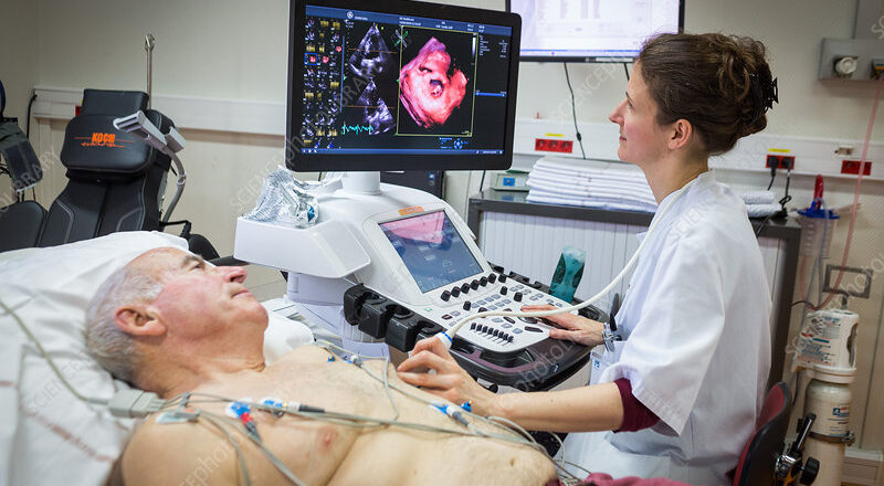 editorial use only  
Dobutamine echocardiography or stress echography, a non-invasive screening for coronary heart disease, cardiology hospital of Bordeaux Hospital, France.